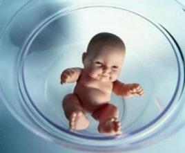 反复流产案例